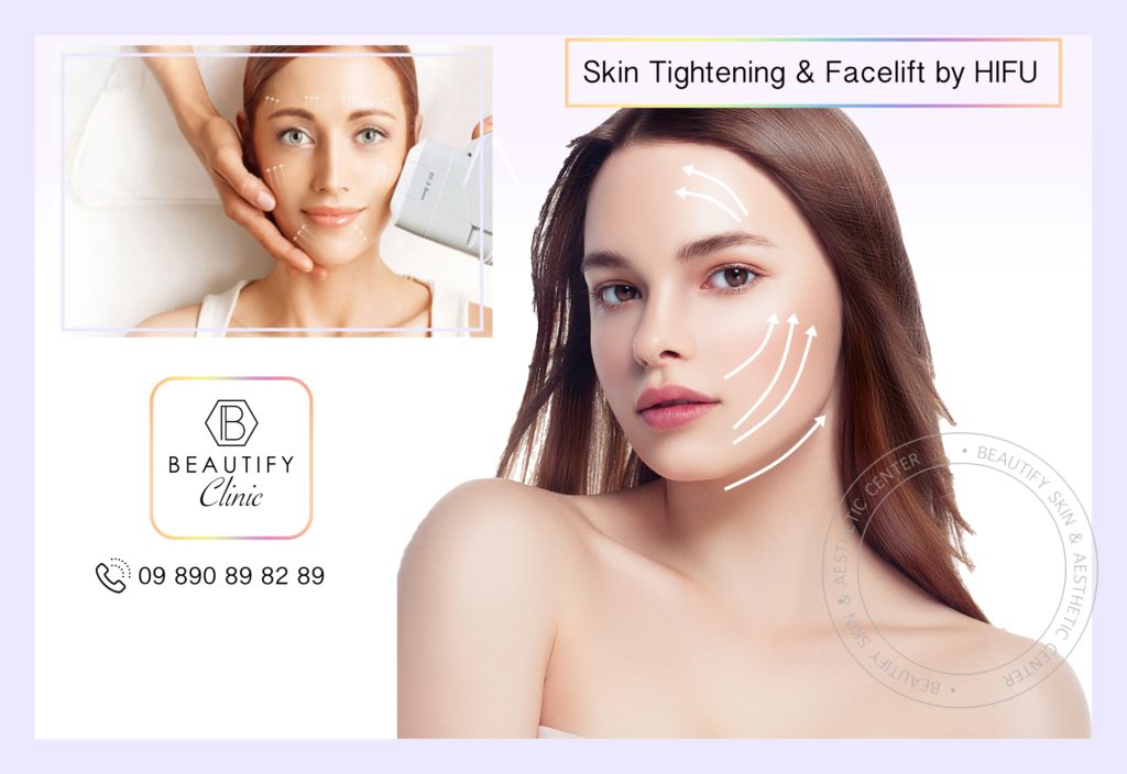 HIFU Facelift