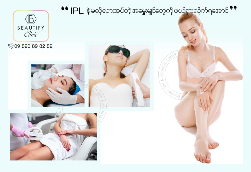 IPL Hair Reduction Treatment